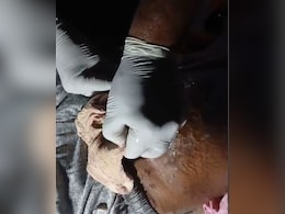 Gauze Left In Woman's Stomach During Surgery At Bihar Hospital Gauze Left In Woman's Stomach During Surgery At Bihar Hospital