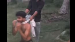 Savage Attack On Andhra Pradesh College Student, Attackers Bit His Cheek