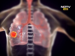 कधीही सिगारेट न पिणाऱ्यानांही का होतो कर्करोग? जाणून घ्या कारणे