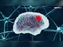 AI Model Detects Residual Brain Tumour In 10 Seconds, Offers Real-Time Guidance