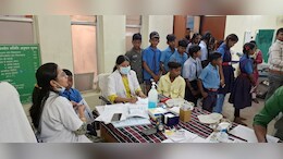 छत्तीसगढ़ के 54 गांवों में इस खतरनाक बीमारी का खतरा ! दांतों में आ गए पीले, भूरे रंग के धब्बे