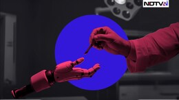 AI vs Medical Experts: Chatbot Outperforms Doctors In Diagnostic Accuracy
