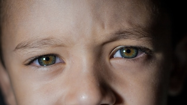 Corrective lenses are the most common treatment for myopia