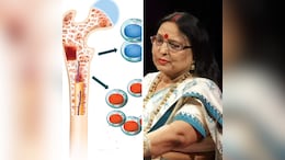 शारदा सिन्हा की मौत के बाद मल्टीपल मायलोमा कैंसर ने बढ़ाई लोगों की चिंता, जानें क्या कहते हैं डॉक्टर