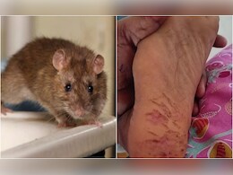 तेलंगाना : 8 महीने में चूहे के 15 बार काटने से लड़की को मारा लकवा, फैमिली ने लगाया ये आरोप तेलंगाना : 8 महीने में चूहे के 15 बार काटने से लड़की को मारा लकवा, फैमिली ने लगाया ये आरोप