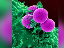 Scientists Unveil 'Conan The Bacterium's' Secret Weapon For Surviving Deadly Radiation