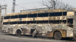 "स्लीपर बस में लोग सो रहे थे, उठने से पहले ही जिंदा जले", जयपुर हादसे में घायलों से मिलकर बोले डोटासरा