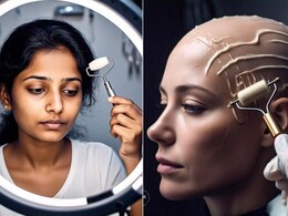 गंजे सिर पर भी बाल उगाने की ताकत रखता है छोटी-छोटी सुईयों वाला ये उपकरण, बस जानना होगा इस्तेमाल का सही तरीका गंजे सिर पर भी बाल उगाने की ताकत रखता है छोटी-छोटी सुईयों वाला ये उपकरण, बस जानना होगा इस्तेमाल का सही तरीका