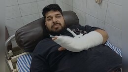 अंतरिम जामीन असूनही आरोपीला पोलिसांची बेदम मारहाण, आरोपीच्या हाताला झालं फ्रॅक्चर