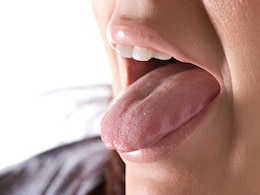 The Tongue May Hold Clues To Detect, Track Motor Neurone Disease: Study The Tongue May Hold Clues To Detect, Track Motor Neurone Disease: Study