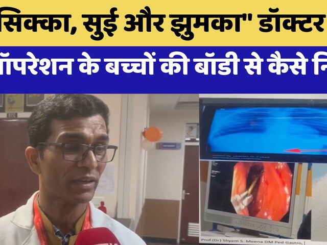 Video : Pakistan से भारत आए 6 साल के बच्चे ने खाया 5 रू का सिक्का, Doctor ने बिना Operation कैसे बचाई जान?