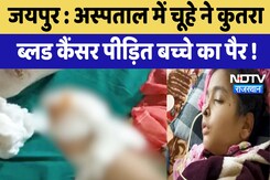 Jaipur News : Hospital में चूहे ने कुतरा Blood Cancer पीड़ित बच्चे का पैर Jaipur News : Hospital में चूहे ने कुतरा Blood Cancer पीड़ित बच्चे का पैर