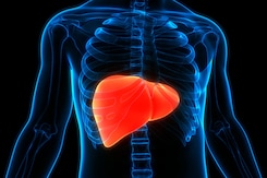 हेपेटाइटिस बी: लक्षण, कारण और उपचार | Hepatitis B: Symptoms, Causes & Treatment हेपेटाइटिस बी: लक्षण, कारण और उपचार | Hepatitis B: Symptoms, Causes & Treatment