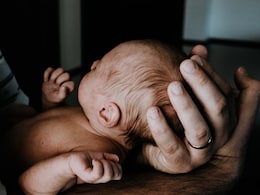 Babies In Spain Develop 'Werewolf Syndrome' After Parents Use Hair-Loss Drug: Report Babies In Spain Develop 'Werewolf Syndrome' After Parents Use Hair-Loss Drug: Report