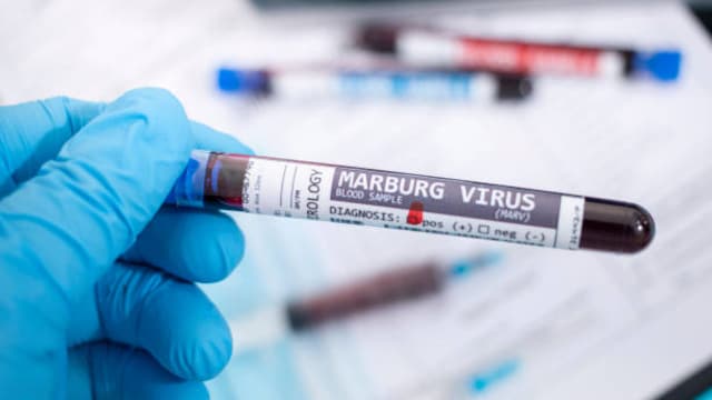 Marburg Disease: How To Prevent Outbreak In India