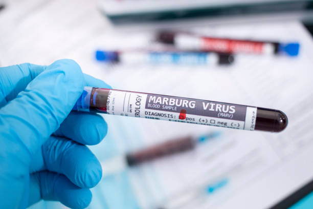 WHO Confirms Marburg Virus Case In Ugandan Toddler Amid Enhanced Ebola Surveillance