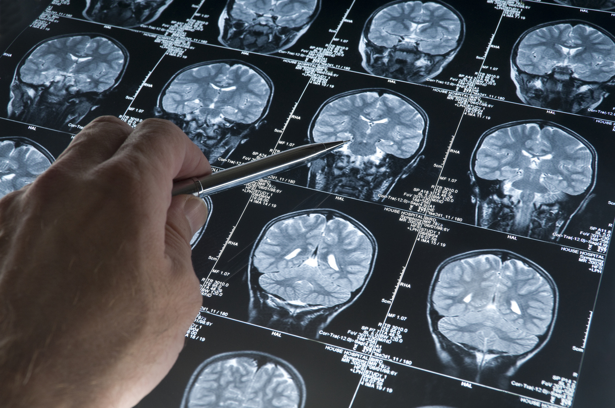 Exercising regularly is one of the effective ways to reduce the risk of Alzheimer's disease