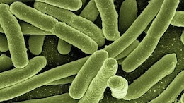 Tanzania Confirms New Outbreak Of Marburg Virus