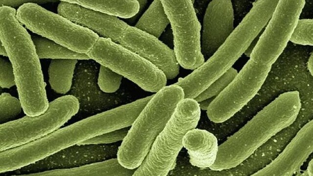 Clean and disinfect surfaces that may have come into contact with body fluids
