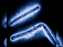US Reports First Severe Infection Of Bird Flu In A Human US Reports First Severe Infection Of Bird Flu In A Human