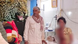 Leopard Attack: उदयपुर में लेपर्ड ने मां के सामने बेटी पर क&zwj;िया हमला, गले और चेहरे पर मारा पंजा; खून से लथपथ&nbsp;
