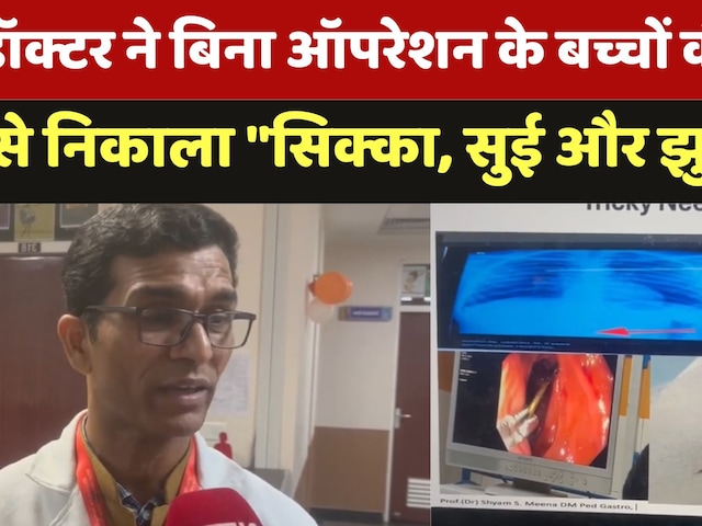 Video : Pakistan से भारत आए 6 साल के बच्चे ने खाया 5 रू का सिक्का, Doctor ने बिना Operation कैसे बचाई जान?