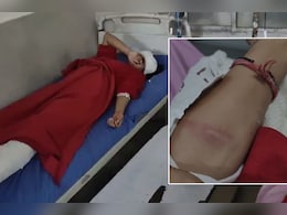 कोटा में पुलिस को देख घबराए स्टूडेंट्स की कार डिवाइडर से टकराई, छात्रों का आरोप- पुलिस ने डंडे से पीटा