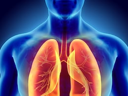 Non Smokers में भी बढ़ रहे हैं Lung Cancer के मामले, वजह जानकर डॉक्टर भी हो गए हैरान Non Smokers में भी बढ़ रहे हैं Lung Cancer के मामले, वजह जानकर डॉक्टर भी हो गए हैरान