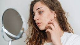 Diabetes Alert: 8 Subtle Physical Clues From Your Body