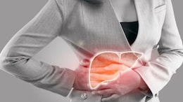 Fatty Liver से बचना तो इस चीज की मदद से बन सकता है काम, मिलेगे चंद दिनों में गजब के फायदे