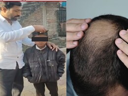 Buldhana Hair Loss : व्हायरसमुळे बुलढाण्यातील गावकऱ्यांना पडतंय टक्कल? केसगळतीत महिलांची संख्या लक्षणीय