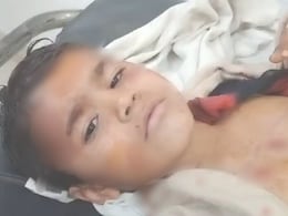 Rajasthan: कुत्‍तों ने पांच साल बच्‍चे को नोच डाला, बच्‍चा लहूलुहान