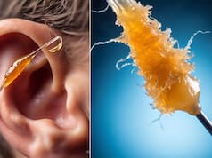 कान का मेल कैसे निकालें? सिर्फ 2 बूंद में सारी गंदगी आ जाएगी बाहर