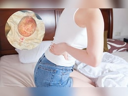 Medical Story: 6 वर्ष पोटदुखी, उपचार घेण्यास टाळाटाळ, शस्त्रक्रियेनंतर सर्वांनाच बसला धक्का Medical Story: 6 वर्ष पोटदुखी, उपचार घेण्यास टाळाटाळ, शस्त्रक्रियेनंतर सर्वांनाच बसला धक्का