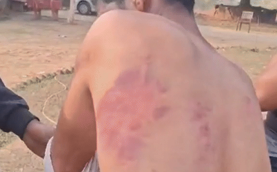 पानी का मटका छूने पर दलित की बेरहमी से पिटाई, किडनैप कर ले गए हरियाणा, फिर देनी पड़ी 1.5 लाख की फिरौती