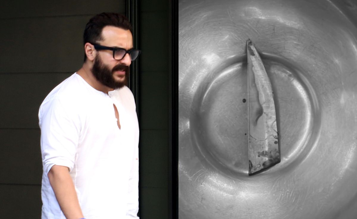 'If Knife Was 2 mm Deeper...': Doctors Say Saif Ali Khan Out Of ICU