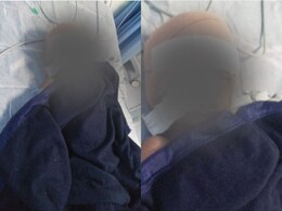 Gwalior: 7 साल के बच्चे को कुत्ते ने 18 जगह काटा, खा गया सिर का 2.5 इंच लंबा हिस्सा, अब लगे 107 टांके Gwalior: 7 साल के बच्चे को कुत्ते ने 18 जगह काटा, खा गया सिर का 2.5 इंच लंबा हिस्सा, अब लगे 107 टांके