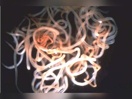 अंधेपन का शिकार बनाने वाले 'ऑन्कोसेरसियासिस' से मुक्त होने वाला पहला अफ्रीकी देश बना नाइजर