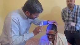 Bald Within A Week: Mass Hair Loss In 3 Maharashtra Villages Sparks Panic