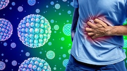 Norovirus Cases Surge In US: Symptoms, Causes, And Treatment