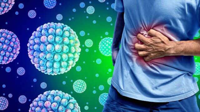 Norovirus Cases Surge In The US: Find Out The Symptoms, Causes, And Treatment