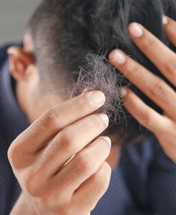 7 Foods To Avoid Hair Thinning