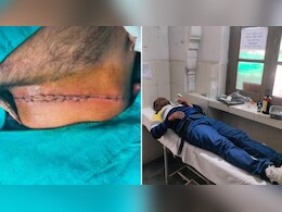 Rajasthan: चाइनीज मांझे से झुंझुनूं में फार्मासिस्ट का कटा गला, आए 14 टांके; चूरू में भी बाइक सवार युवक घायल