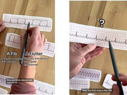 Understanding ECG: एक नहीं कई तरह के होते हैं दिल की धड़कन बताने वाले ईसीजी, जानें इलेक्ट्रोकार्डियोग्राम (ईसीजी) कैसे पढ़ें Understanding ECG: एक नहीं कई तरह के होते हैं दिल की धड़कन बताने वाले ईसीजी, जानें इलेक्ट्रोकार्डियोग्राम (ईसीजी) कैसे पढ़ें