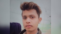 Chinese Manjha Slits UP Man's Throat, He Was Returning After Buying Some