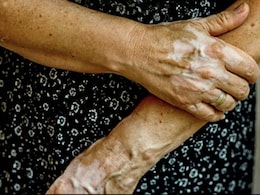 Guillain Barre Syndrome : गुइलेन बॅरे सिंड्रोममुळे चिंता वाढली, 12 रुग्ण व्हेंटिलेटरवर; काय काळजी घ्याल? Guillain Barre Syndrome : गुइलेन बॅरे सिंड्रोममुळे चिंता वाढली, 12 रुग्ण व्हेंटिलेटरवर; काय काळजी घ्याल?
