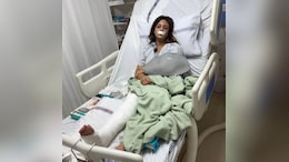 Salman Khan's Rakhi Sister Shweta Rohira Shares Pics After Major Accident: "Fractured Bones, Bruises And..."