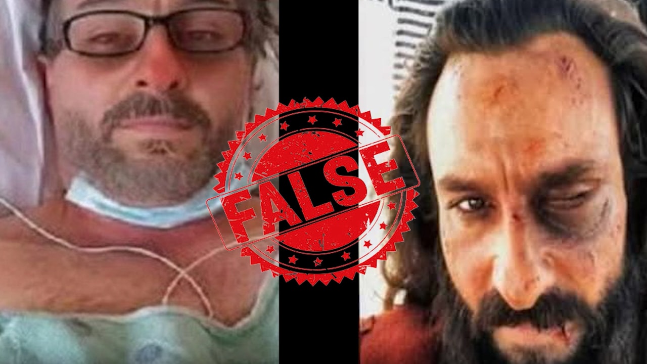 Fact Check: Old, Edited Images Falsely Claim To Show Saif Ali Khan After The Attack