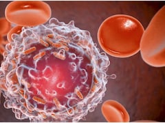 Doctor Shares 7 Simple Habits To Reduce Cancer Risk In Young Adults