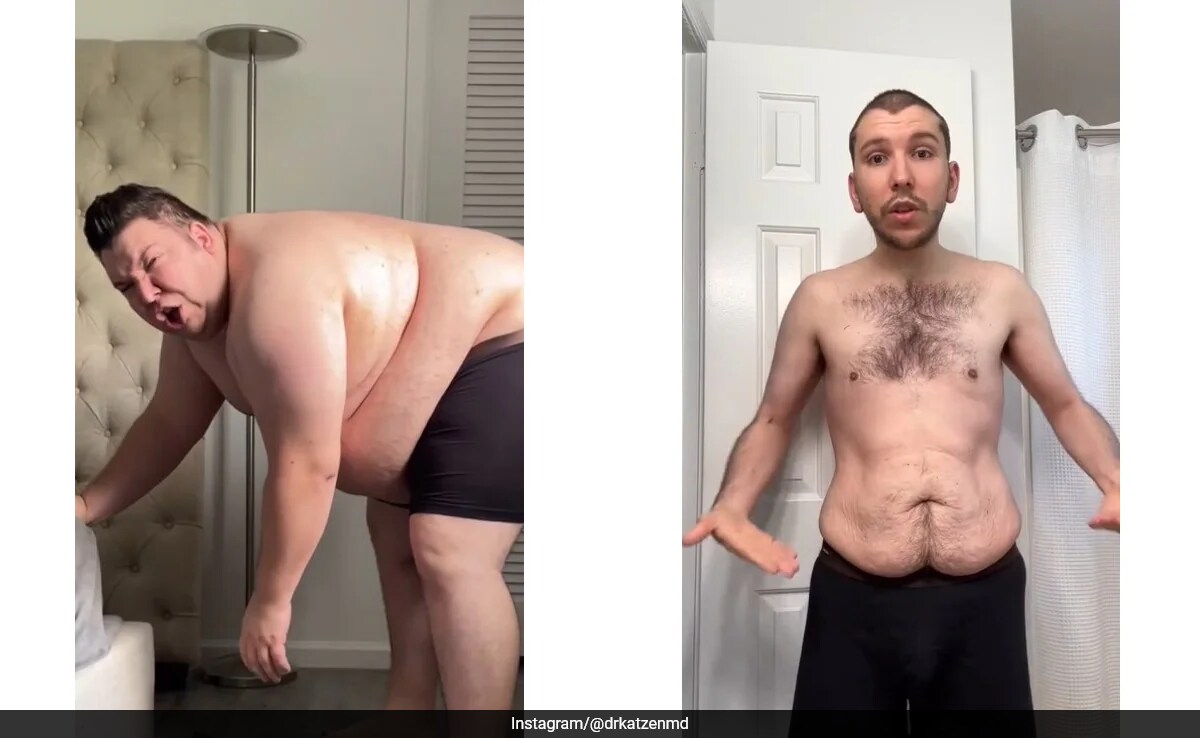 Nikocado avocado nakes